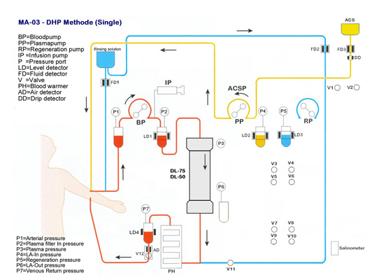 LDL Apheresis