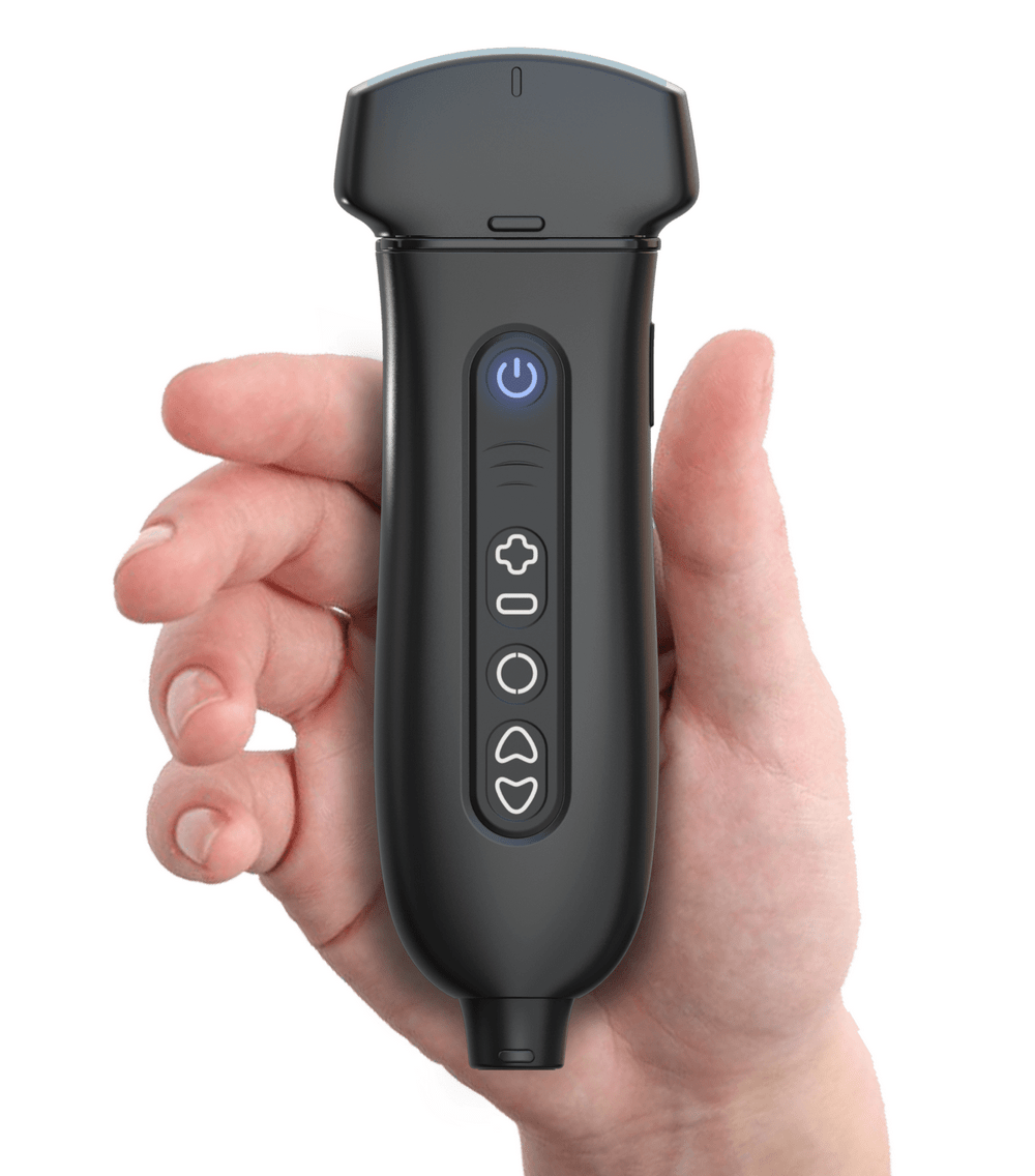 Youkey-Q7-sonda-ecografica-ultraportatile-emac-min