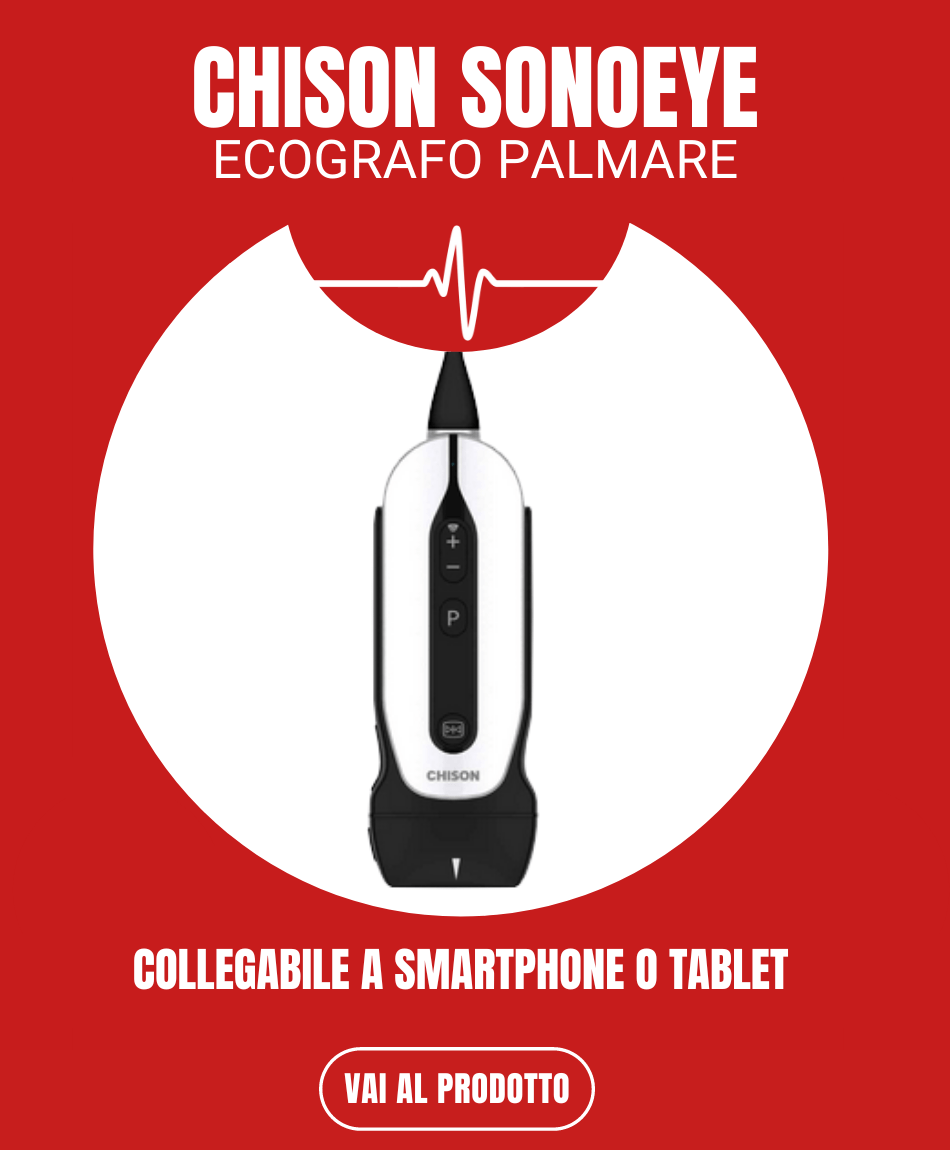 Ecografo palmare collegabile a smartphone tablet chison sonoeye-min