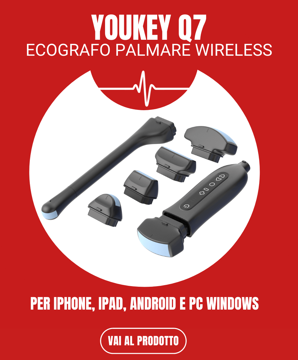 Ecografo palmare youkey q7 wireless iphone ipad android pc windows-min
