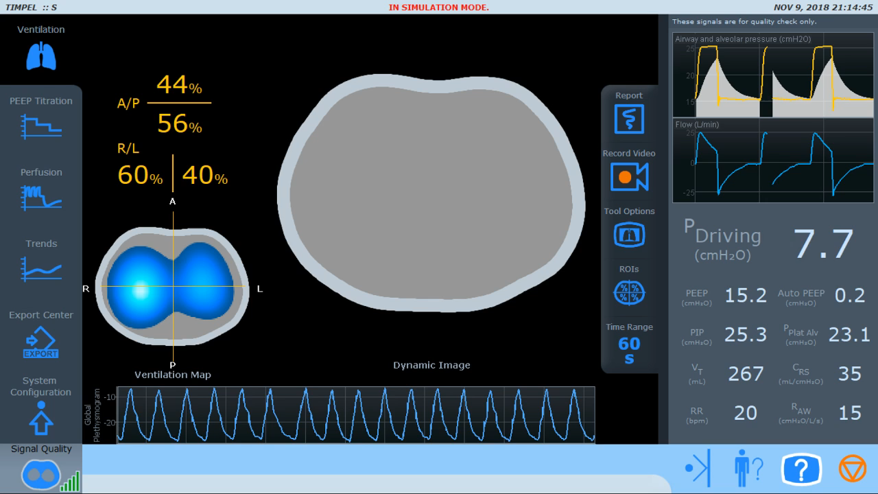 emac – tomografia – critical care